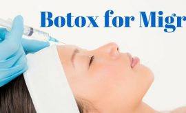 Botox for Migraines